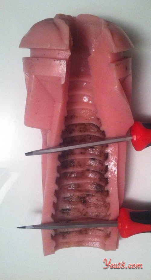 Hình ảnh vệ sinh âm đạo giả không đúng cách