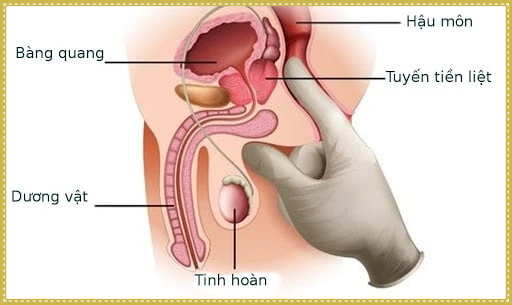 Điểm G - Tuyến tiền liệt ở đàn ông
